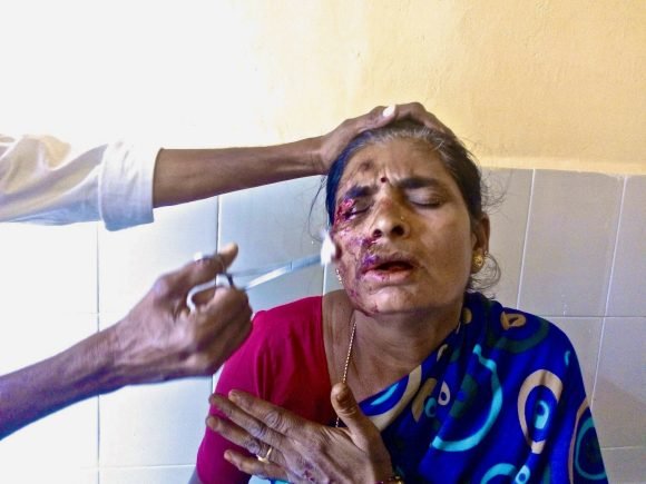Rural Health Camp – Maskal Village, Chitradurga District